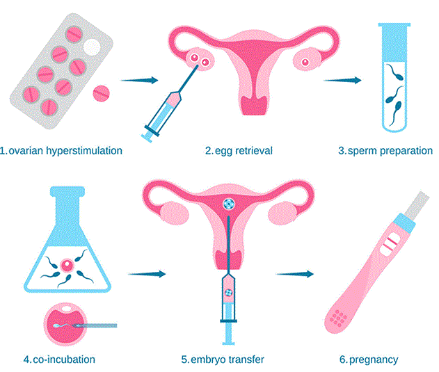 IVF Process Mumbai