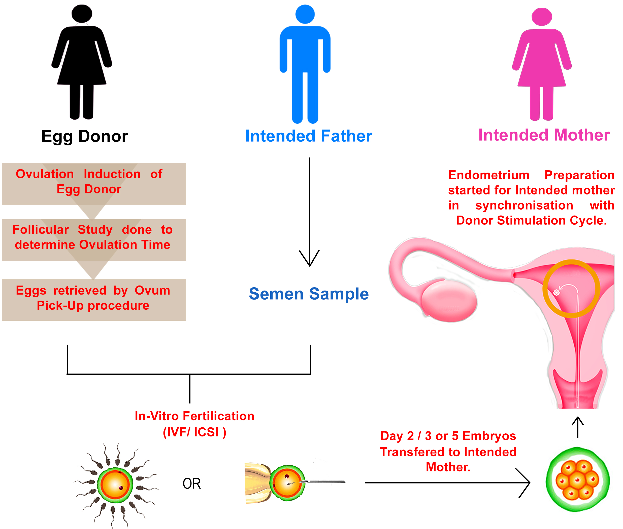 Ivf With Egg Donor IVF Surrogacy