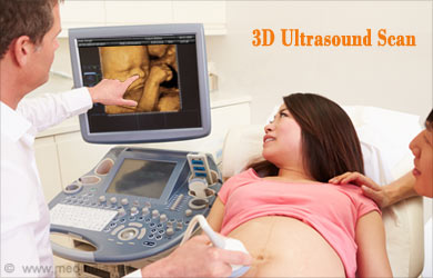 3D and 4D Pregnancy Ultrasounds