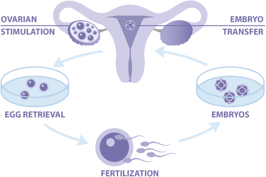 IVF Treatment in Noida