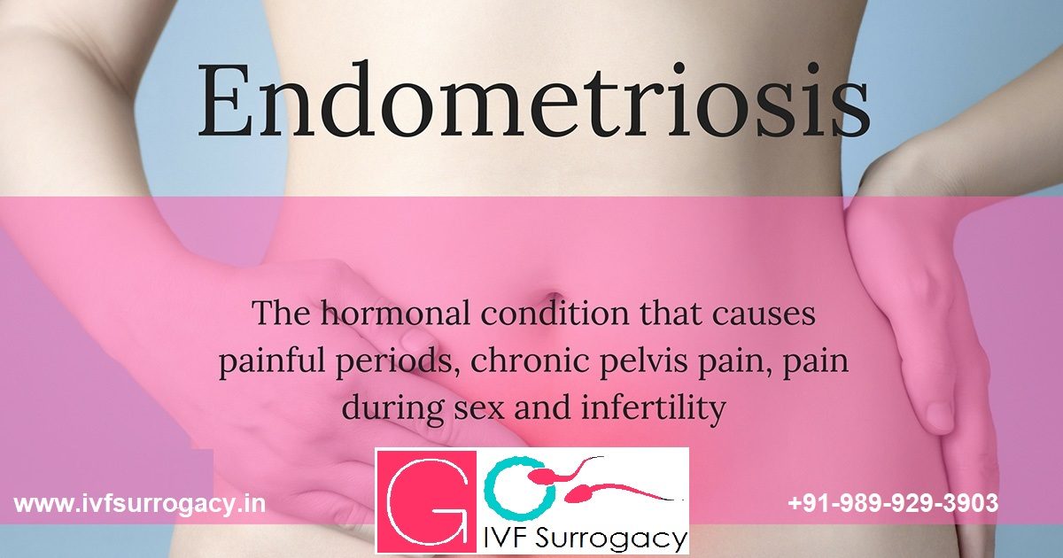 Endometriosis-1200x630.jpg