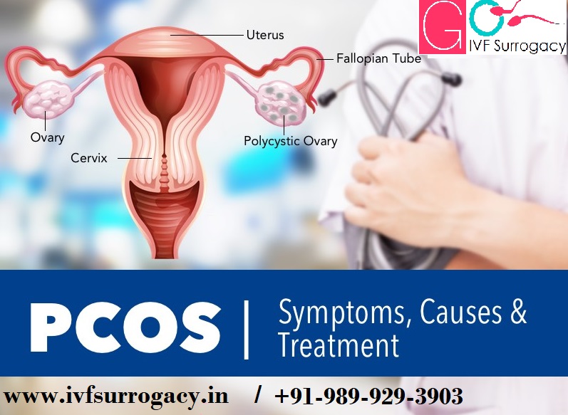 PCOS-Polycystic-Ovary-Syndrome-Symptoms-Causes-and-Treatment.jpg