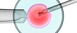 IMSI with IVF treatment 