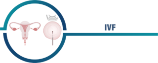 ivf cost in uae
